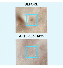 KONTROLA PIGMENT - Patch 2 - (Stanny Sol & Age) - Talika