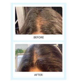 Kit per capelli per capelli e booster Talika